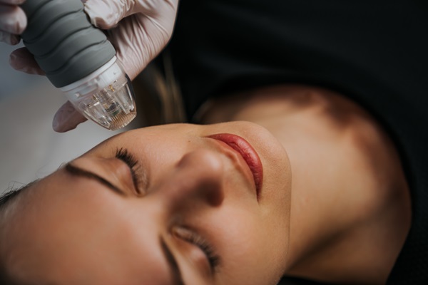 Microneedling Treatment For Healthier Skin